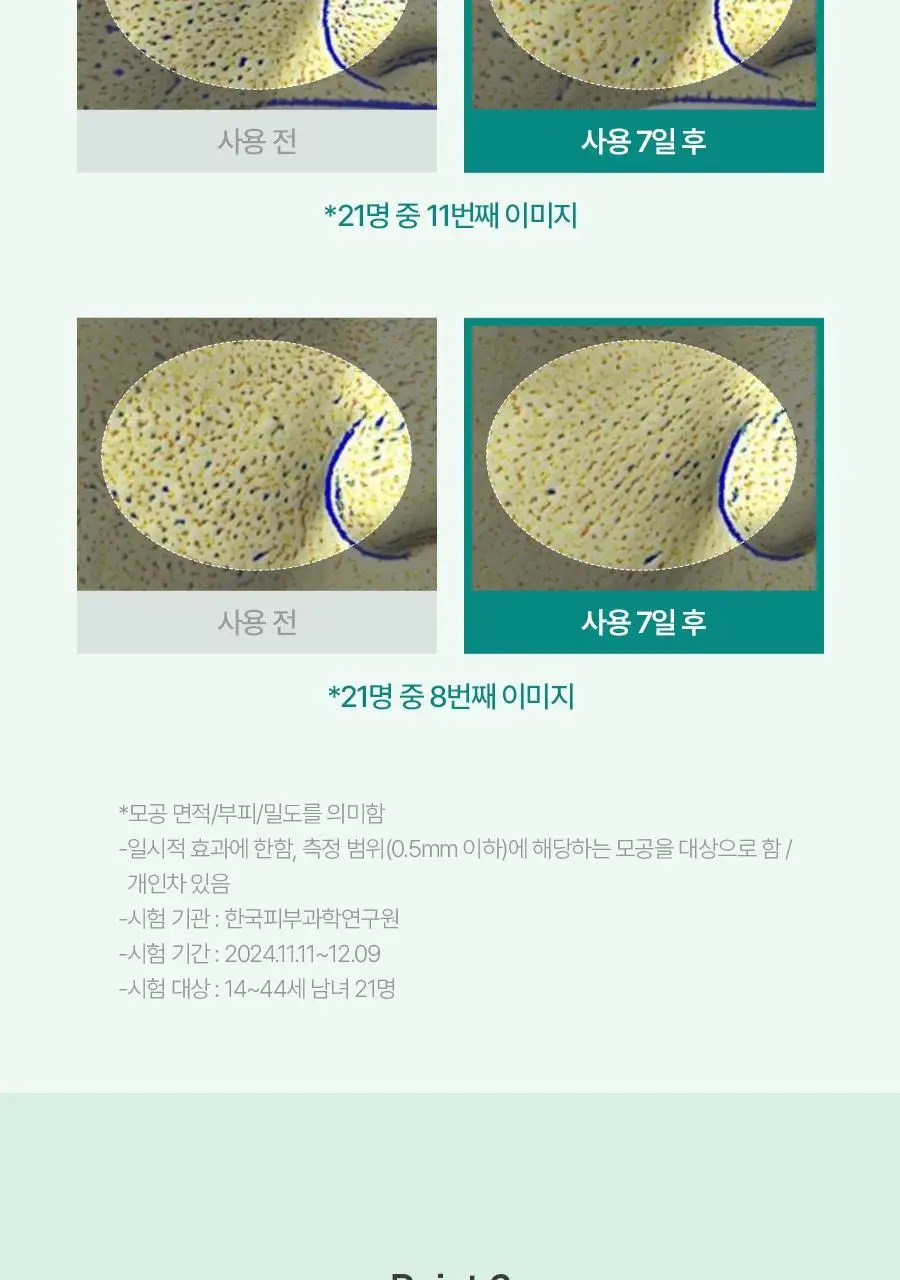 [피지&모공 7일케어] 비욘드 엔젤 티트리올 10% 트러블 앰플 50ml 상세페이지 16